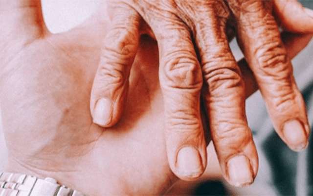 Joint injections, creams ineffective for treating hand arthritis: Study